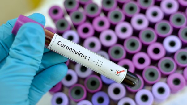 CoronaVirus– Patent Infringemnet CoronaVirus– Patent Infringemnet